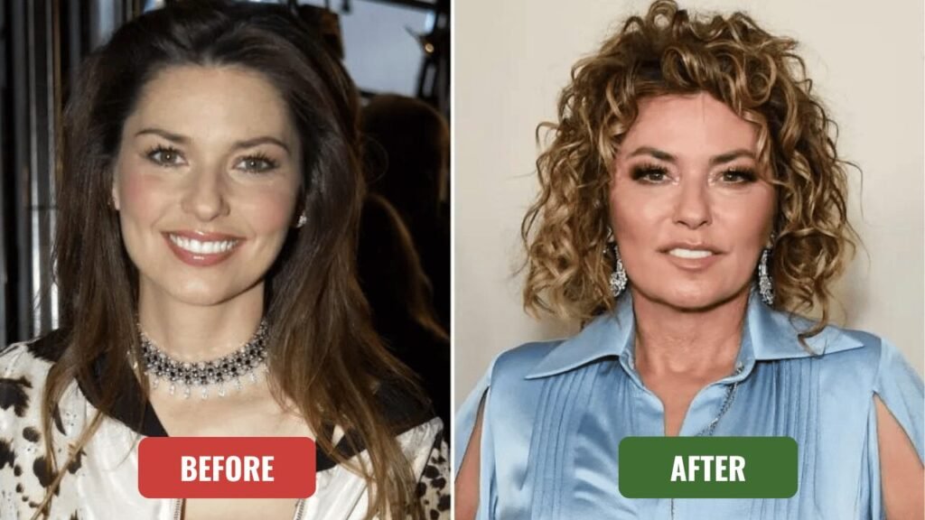 shania twain plastic surgery