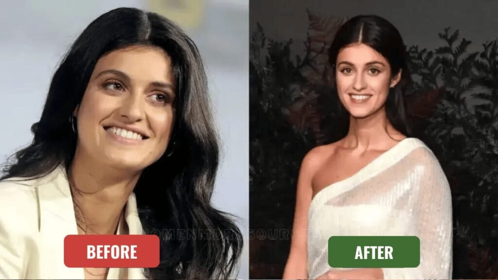 anya chalotra plastic surgery