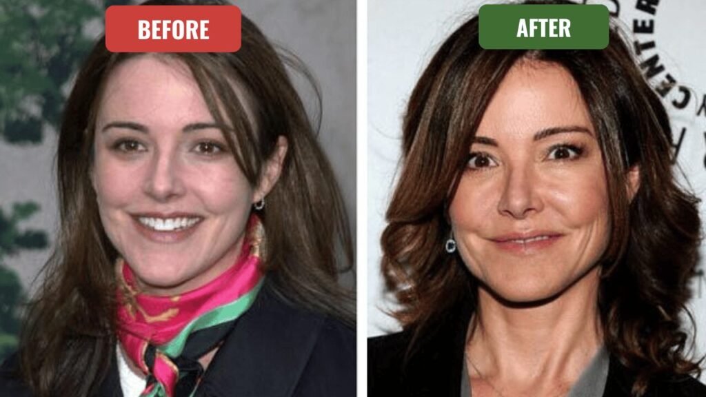 christa miller plastic surgery