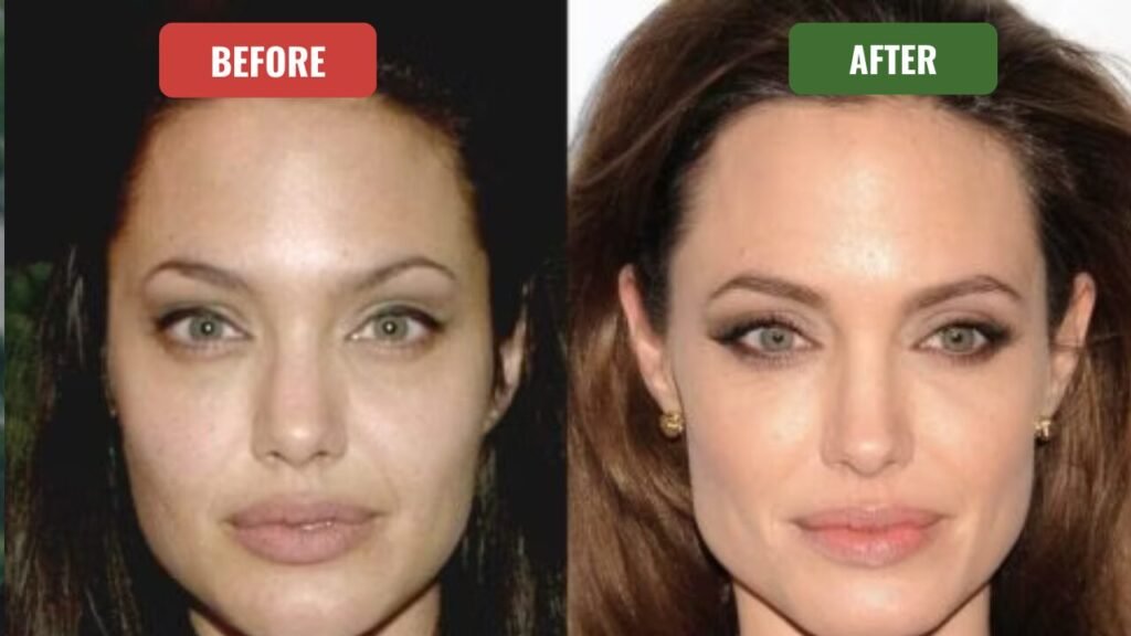 angelina jolie plastic surgery