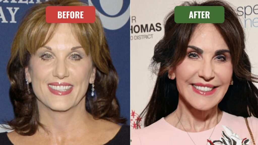 robin mcgraw plastic surgery