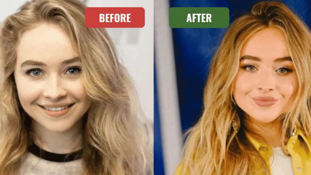 sabrina carpenter plastic surgery