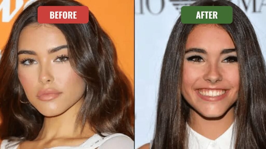 madison beer plastic surgery