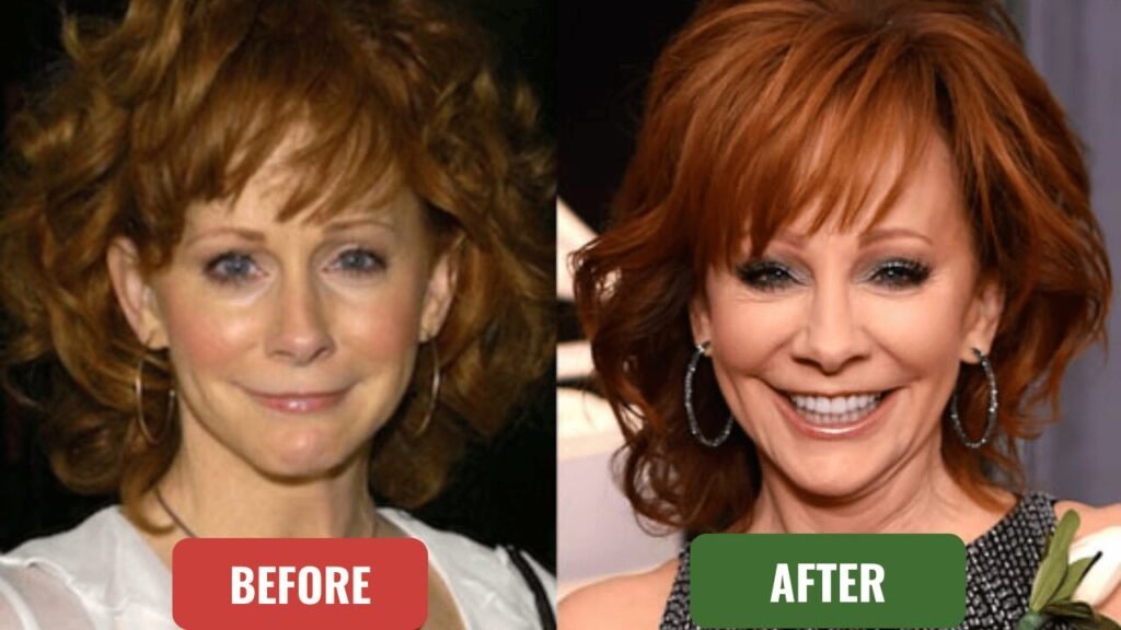 reba mcentire plastic surgery