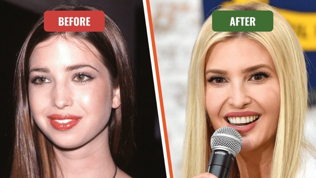 ivanka before plastic surgery