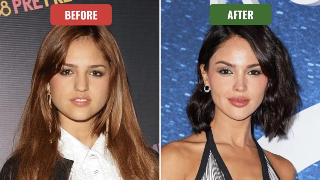 eiza gonzález plastic surgery