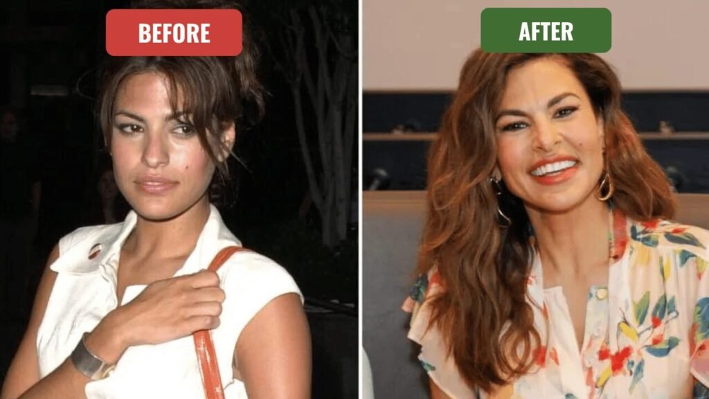 eva mendes plastic surgery