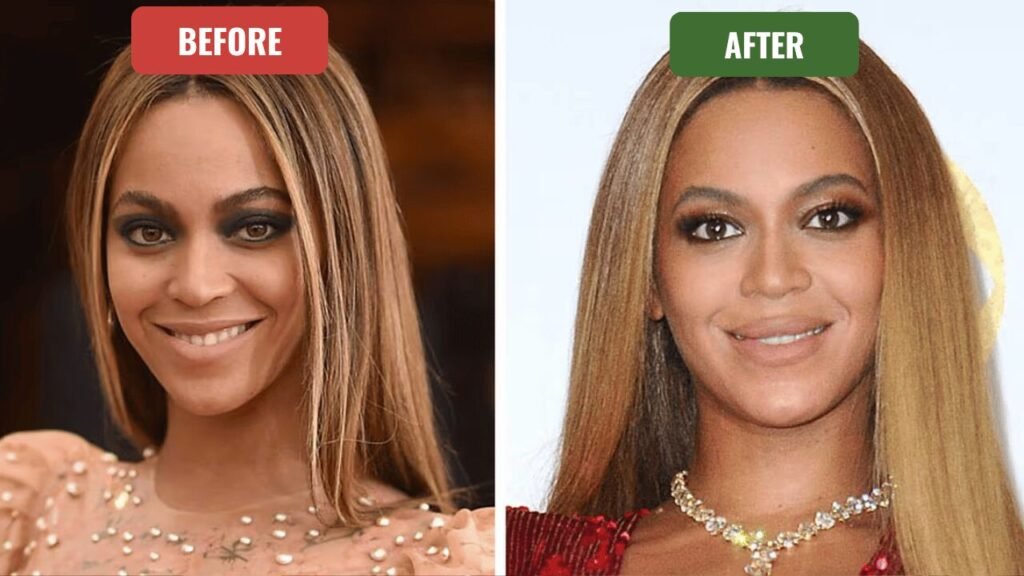 beyonce plastic surgery