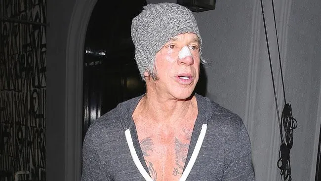 mickey rourke plastic surgery