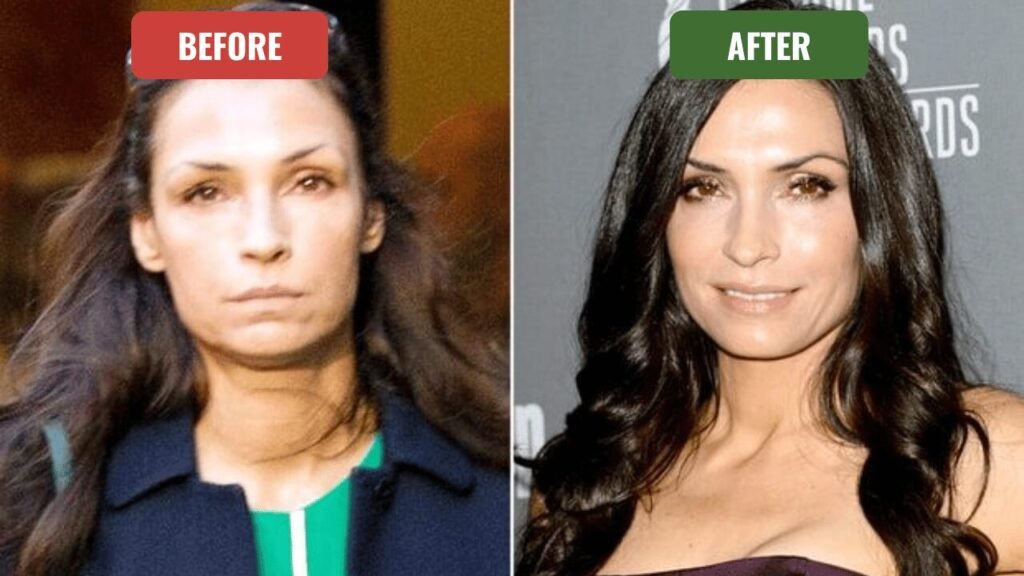 famke janssen plastic surgery