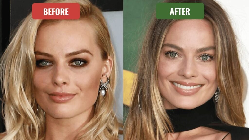 margot robbie plastic surgery