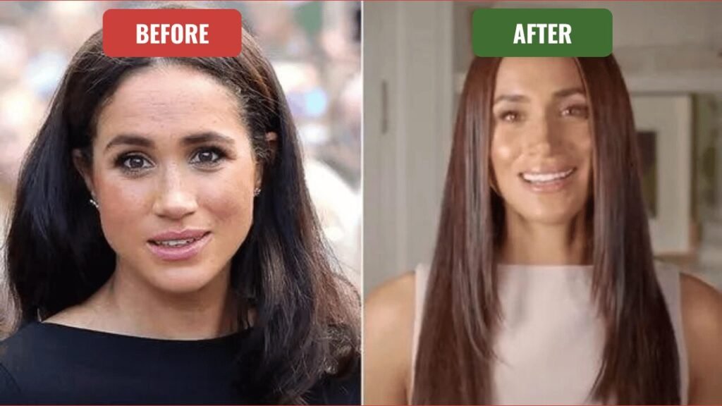 meghan markle plastic surgery