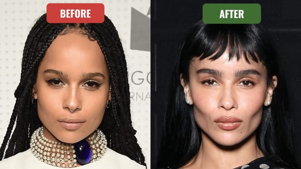 zoe kravitz plastic surgery