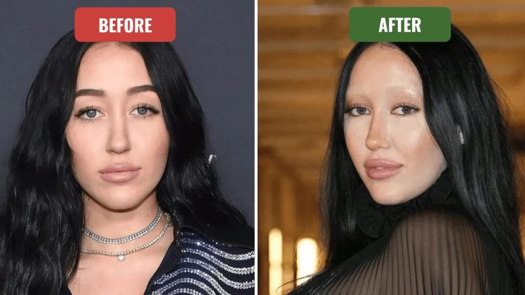 noah cyrus plastic surgery