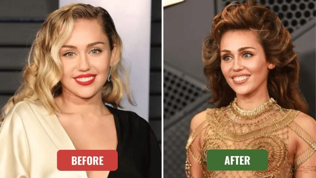 miley cyrus plastic surgery