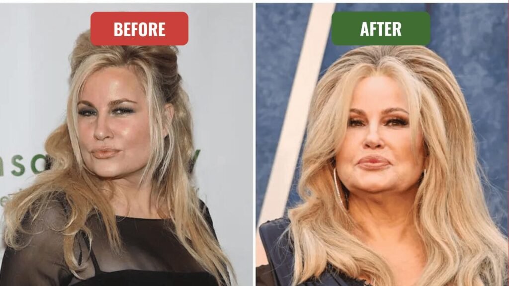 jennifer coolidge plastic surgery