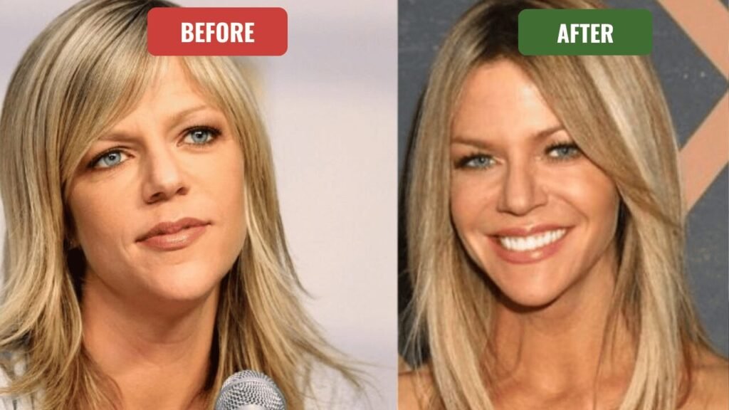 kaitlin olson plastic surgery