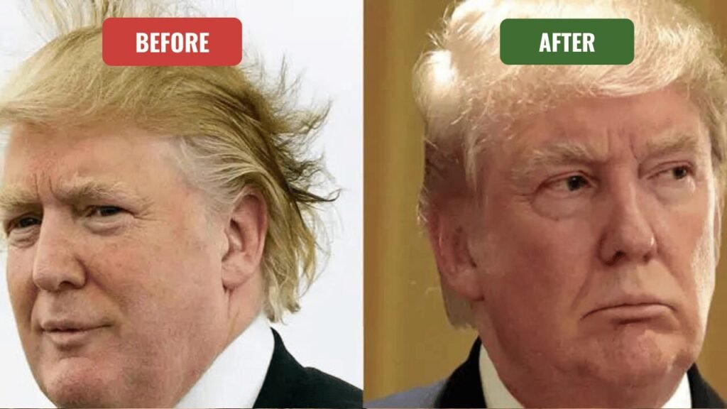 trump plastic surgery