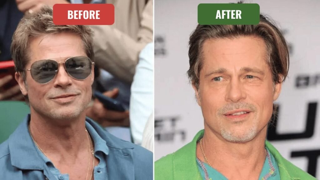 brad pitt plastic surgery