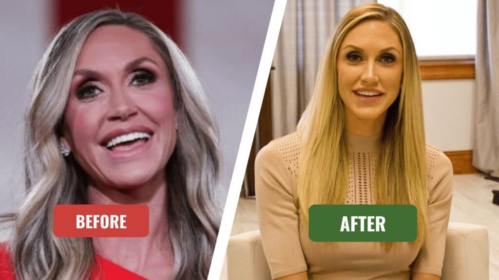 lara trump plastic surgery