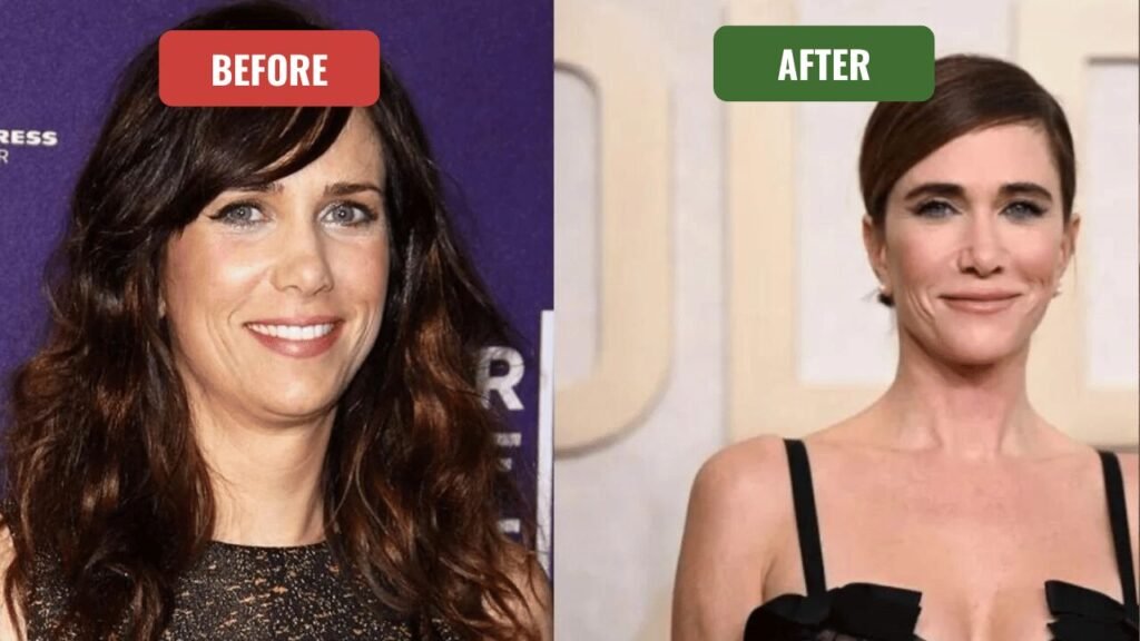 kristin wiig plastic surgery