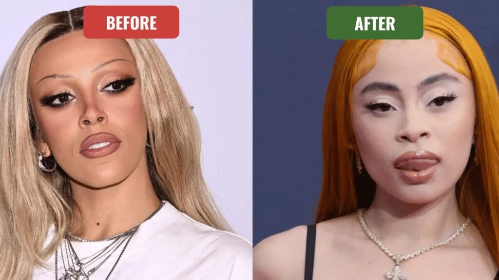 doja cat plastic surgery