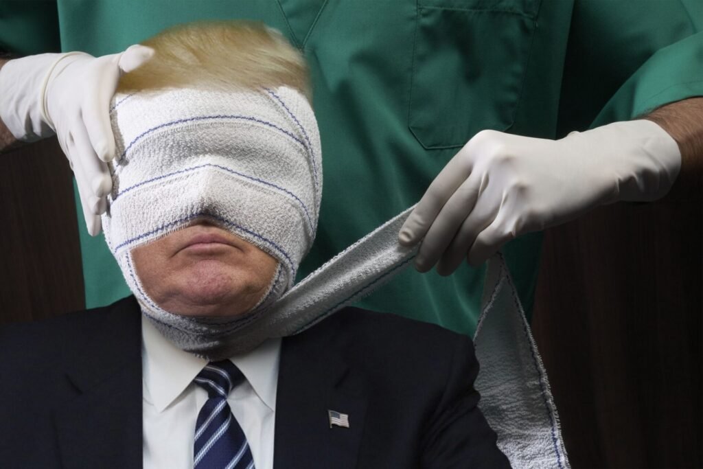 trump plastic surgery