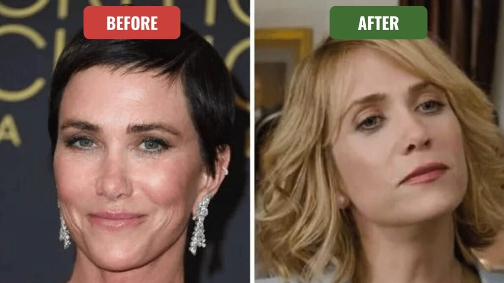 kristen wiig plastic surgery